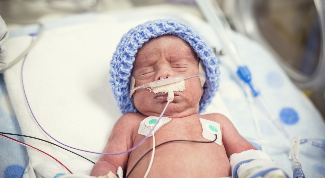 Newborn premature baby in the NICU intensive care