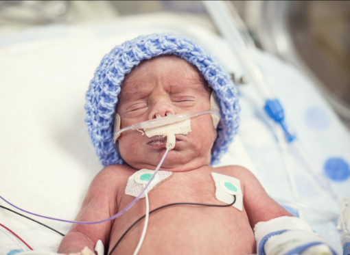 Newborn premature baby in the NICU intensive care