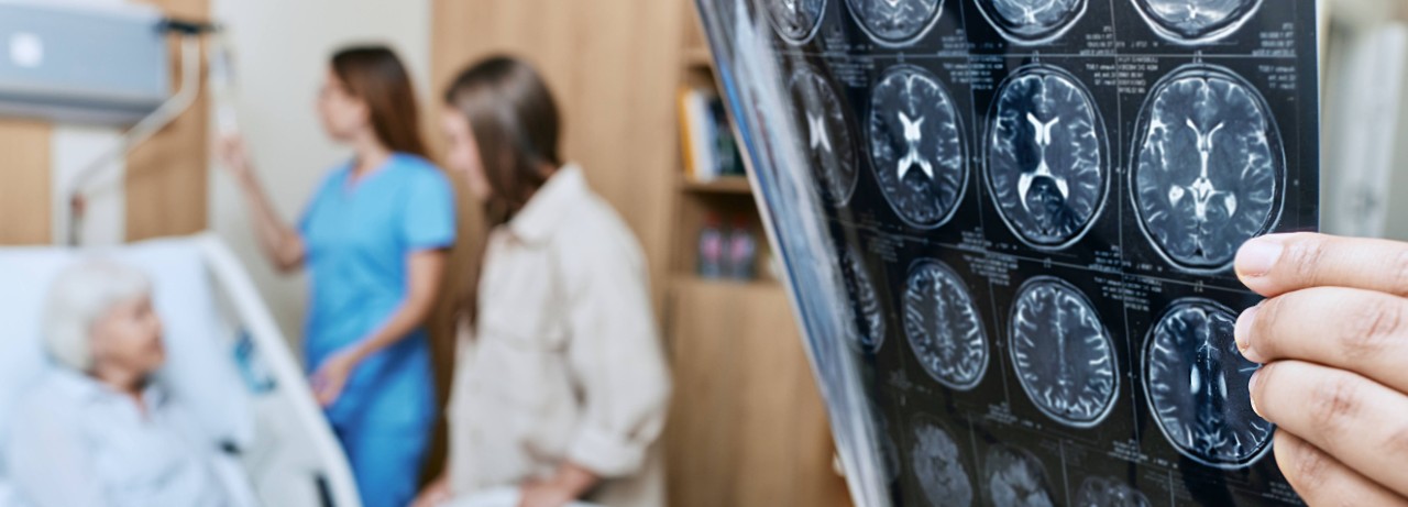 Schlaganfall_MRT-Auswertung_Slider