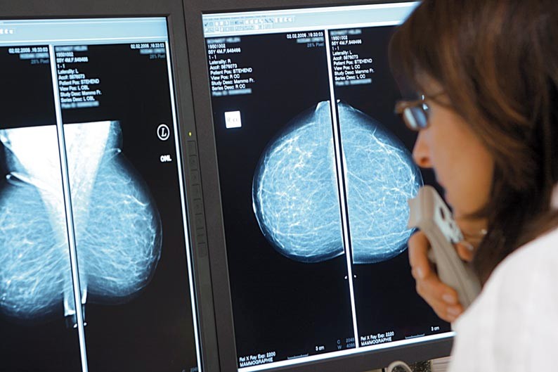 Ärztin betrachtet CT-Bilder beim Mammographie-Screening
