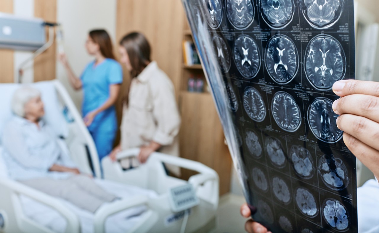 CT-Aufnahmen eines Gehirns im Patientenzimmer CT-Aufnahmen eines Gehirns im Patientenzimmer
