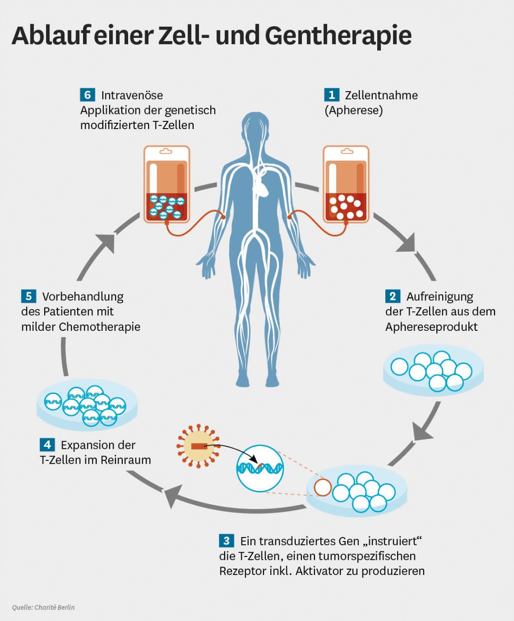 Infografik: Ablauf einer Zell- und Gentherapie Infografik: Ablauf einer Zell- und Gentherapie