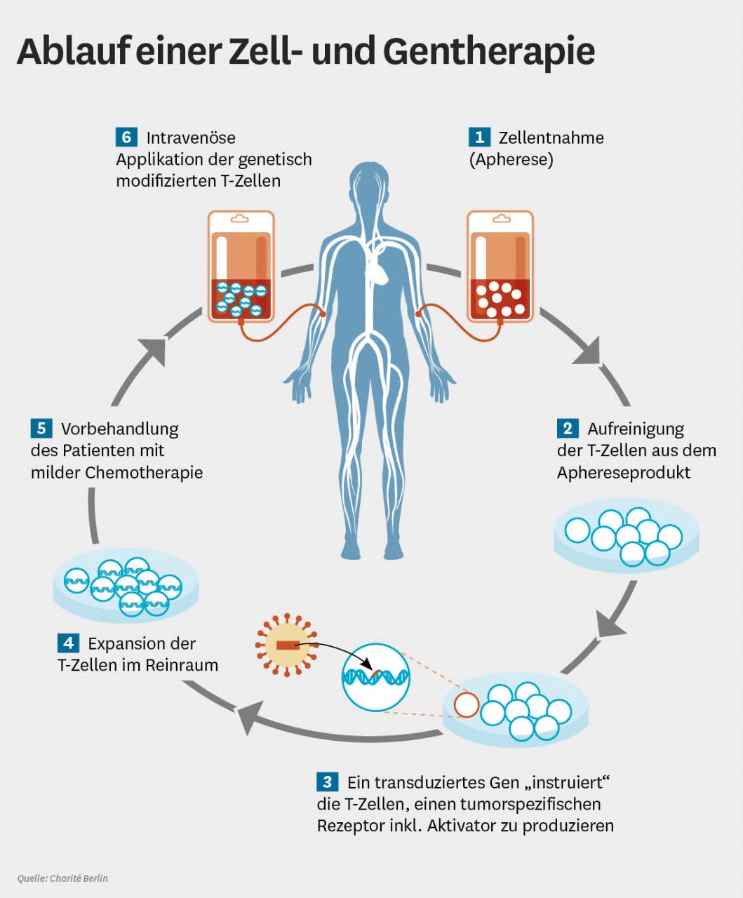 Infografik: Ablauf einer Zell- und Gentherapie