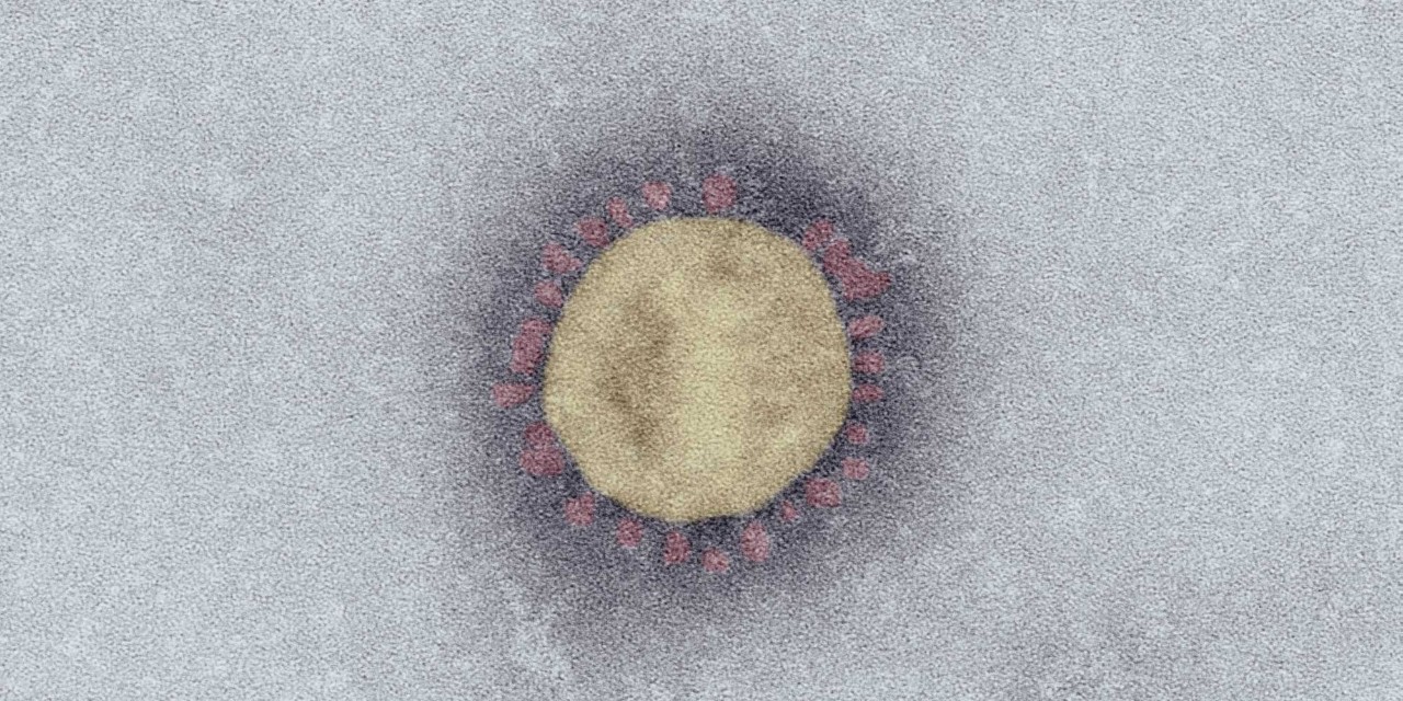 SARS-Coronavirus-2, Elektronenmikroskopie, Negativkontrastierung (PTA). Maßstab: 100 nm