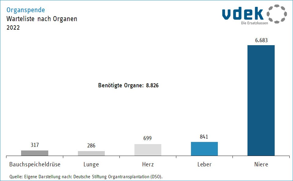 Säulendiagramm zeigt die Warte liste nach Organen im Jahr 2022