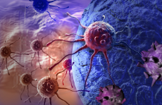 Krebszelle und Lymphozyten, 3D-Abbildung