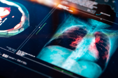 Medizinischer MRT-Scan einer Lunge