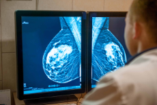 Arzt bei Auswertung einer Mammographie-Momentaufnahme 